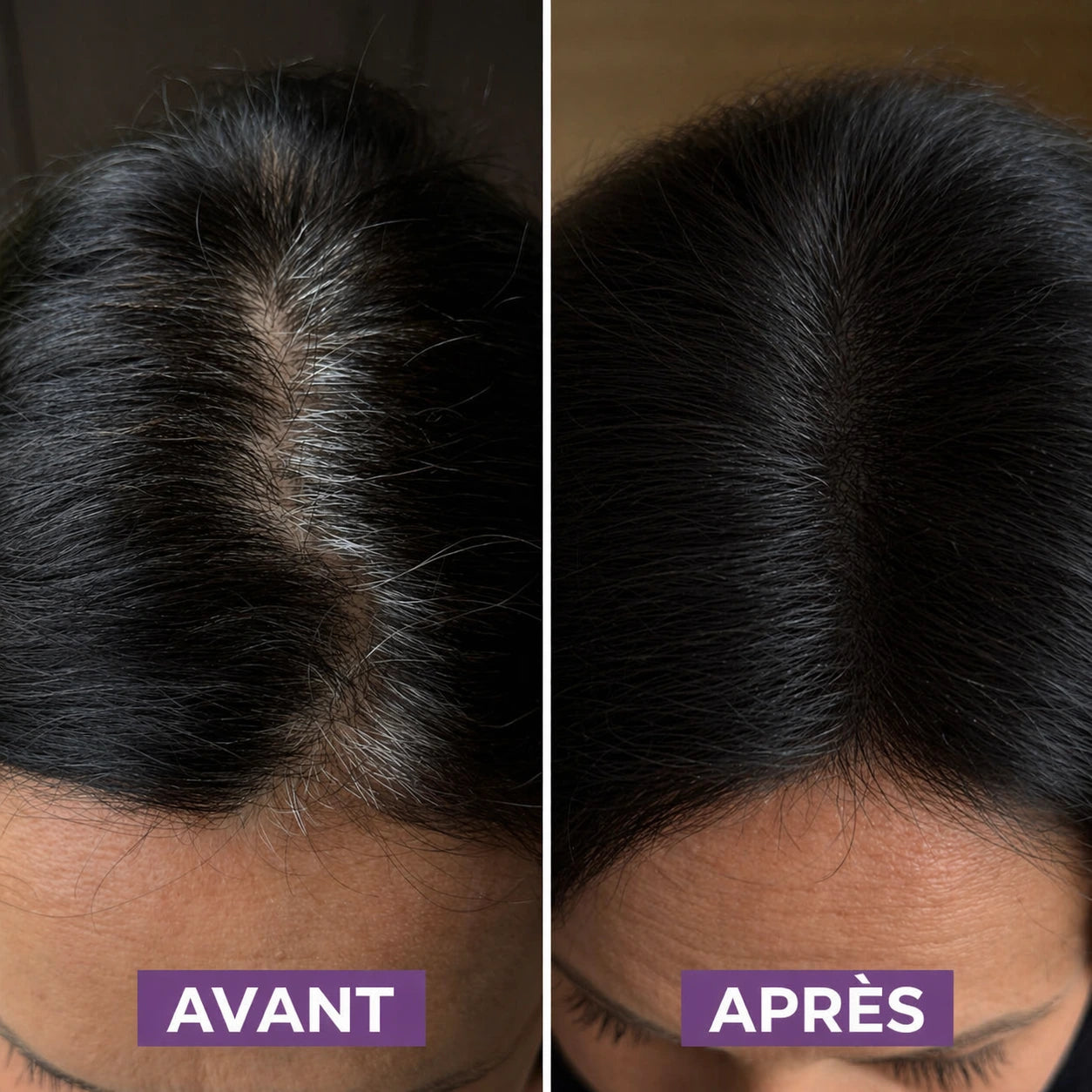 Avant après