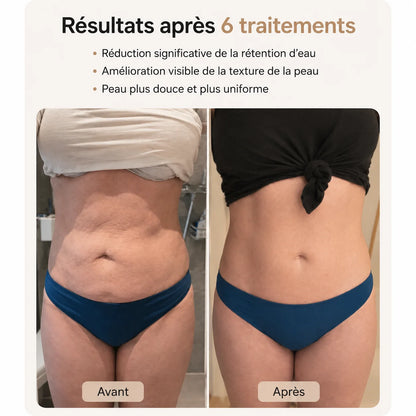 Kalensia™ SkinLift - une peau lisse en 14 jours